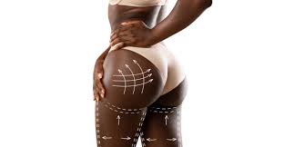 Buttock Enhancement